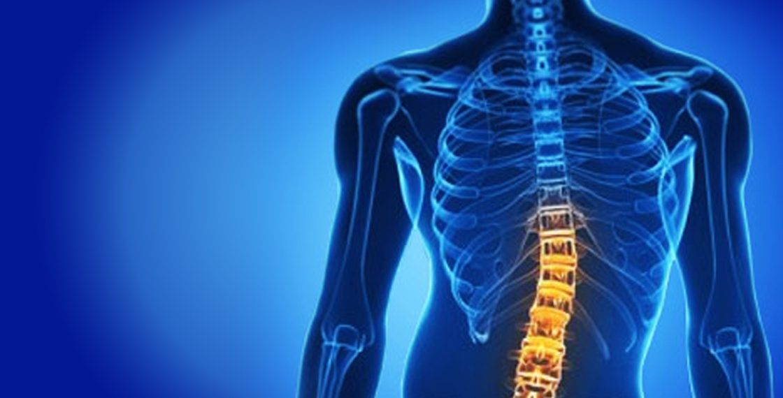 Justiça determina que Estado custeie tratamento de escoliose em adolescente carente