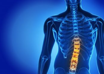 Justiça determina que Estado custeie tratamento de escoliose em adolescente carente