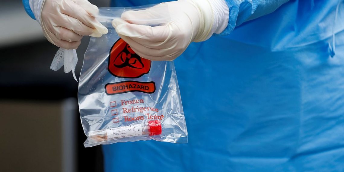 Cientistas chineses anunciam descoberta contra covid-19