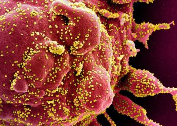 Estudo da UFRN traça perfil da Síndrome Respiratória Aguda Grave no Nordeste