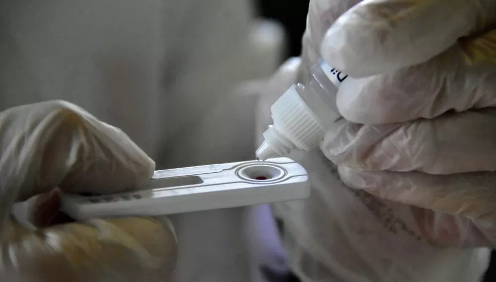 RN tem 19.206 casos confirmados e 697 mortes por coronavírus