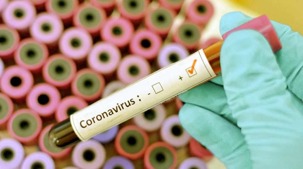 UFRN tem projetos selecionados em editais nacionais da covid-19