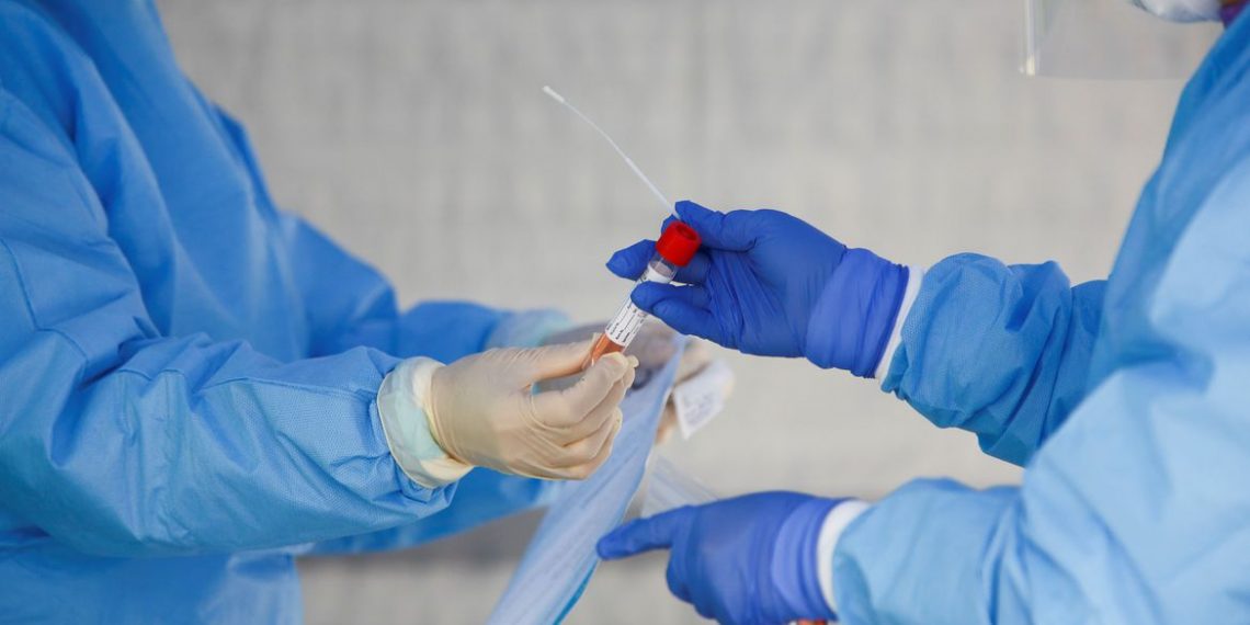 Número de casos do novo coronavírus no Brasil ultrapassa 510 mil