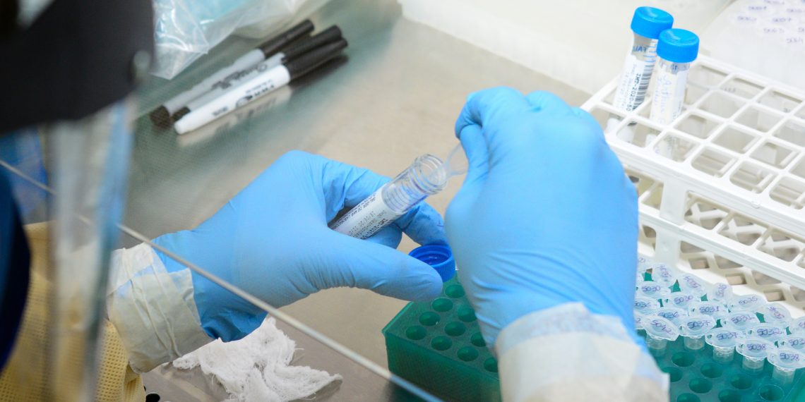 IMT ultrapassa os 10 mil testes de covid-19