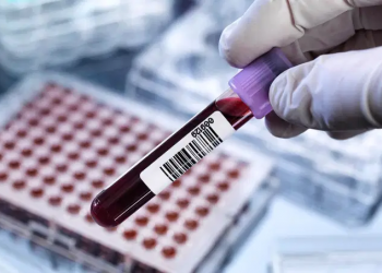 Exame de sangue pode detectar câncer anos antes dos primeiros sintomas