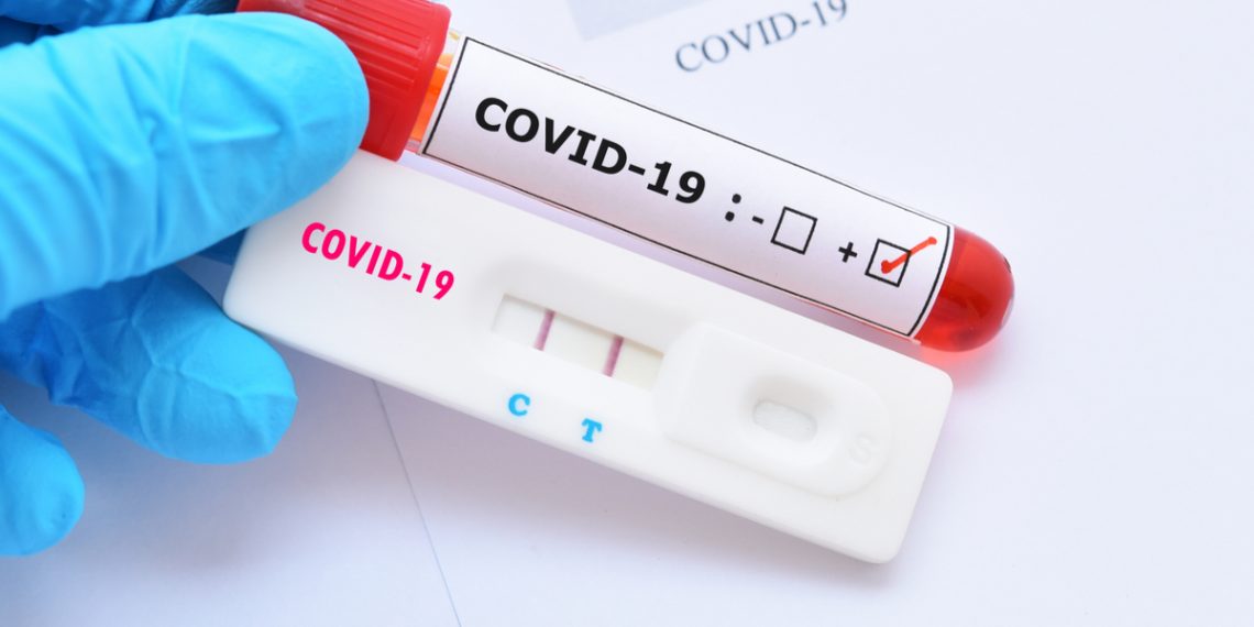 UFRN realiza quase 50 mil testes da covid-19