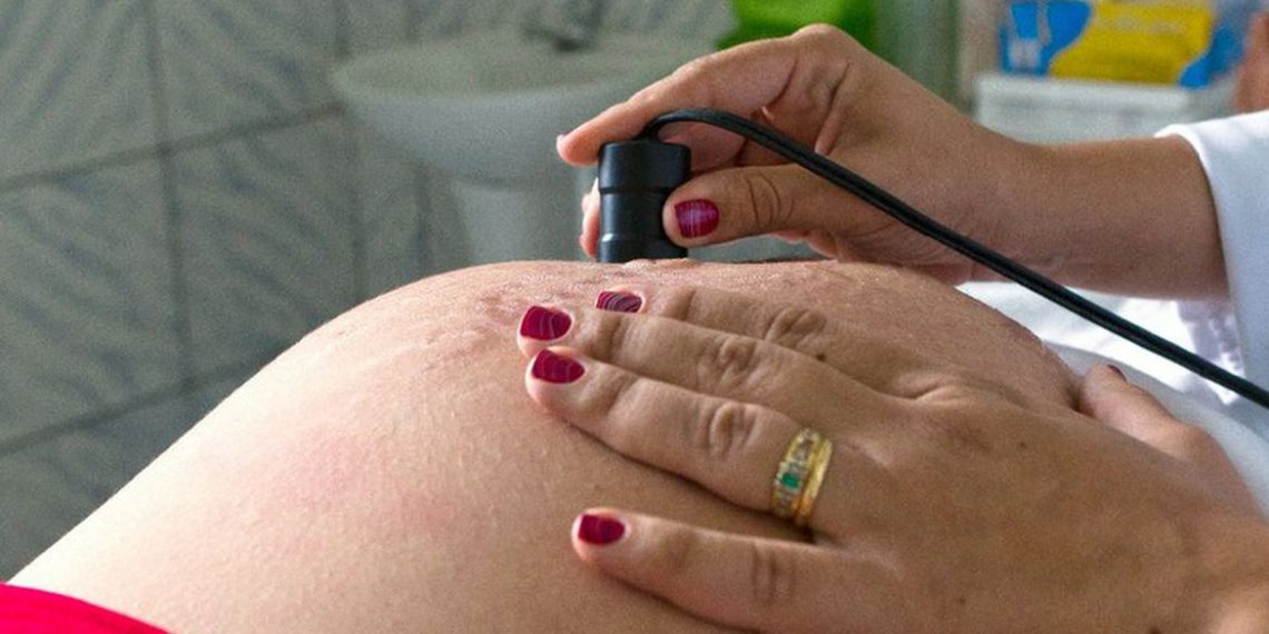 Covid-19: mortalidade de gestantes é mais que o dobro da média no país