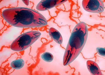 Estudo encontra associação entre toxoplasmose ocular e polimorfismo do gene APEX1