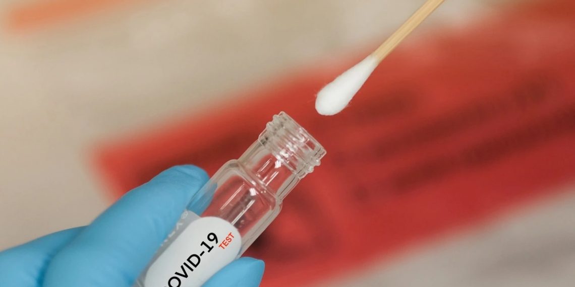 IMT supera 185 mil exames para detecção da Covid-19 e manterá vigilância por mais 12 meses