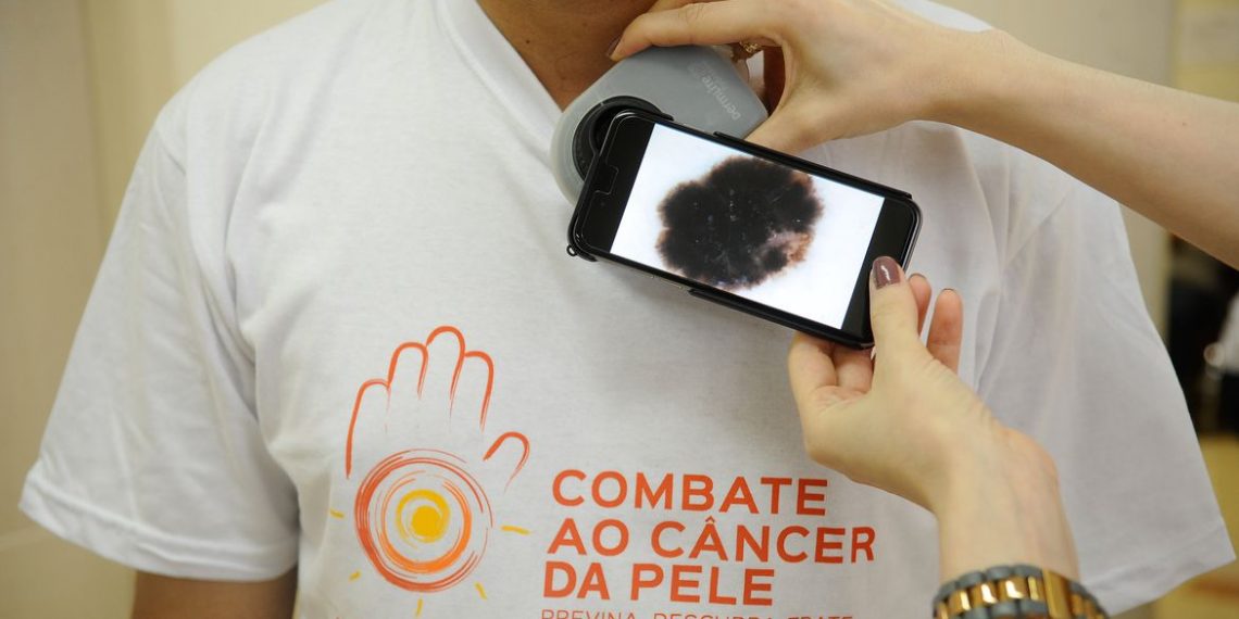 Guia procura esclarecer relação entre covid-19 e lesões de pele