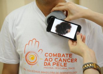 Guia procura esclarecer relação entre covid-19 e lesões de pele