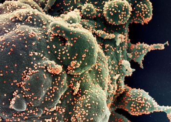 Covid-19: casos confirmados no mundo diminuíram 16% na última semana