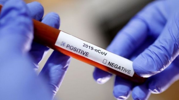 Covid-19: RN registra 104 novos casos da doença no domingo