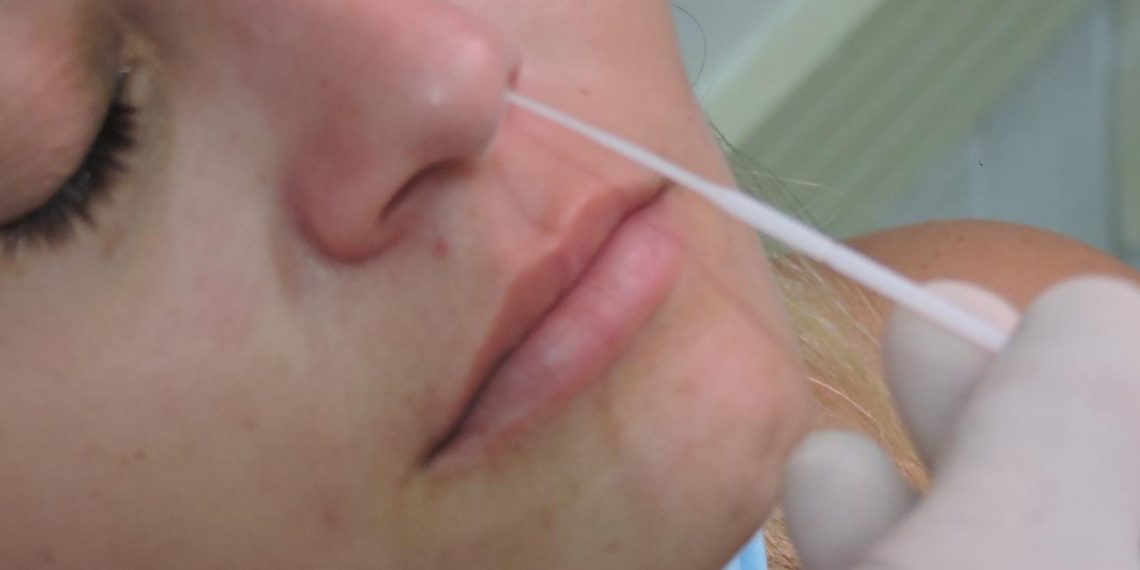 Parnamirim: Laboratório Central alerta quem está com sintomas gripais deve fazer o exame de Covid 19