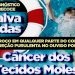 Casa Durval Paiva alerta sobre diagnóstico precoce do Câncer dos Tecidos Moles