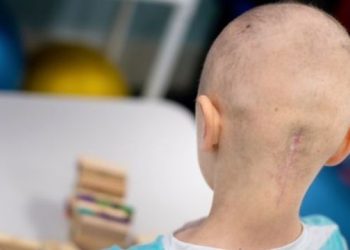 Reabilitação de crianças com tumor de sistema nervoso central