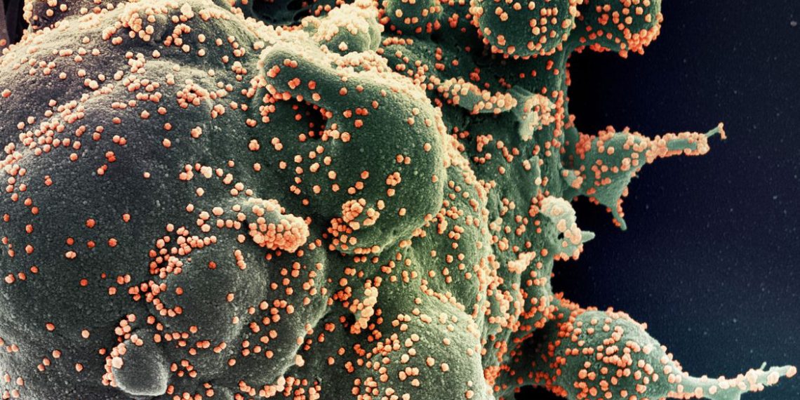 Fiocruz identifica subvariante BA.5.3.1 do coronavírus no Amazonas