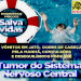 Casa Durval Paiva alerta sobre sinais e sintomas dos tumores do sistema nervoso central