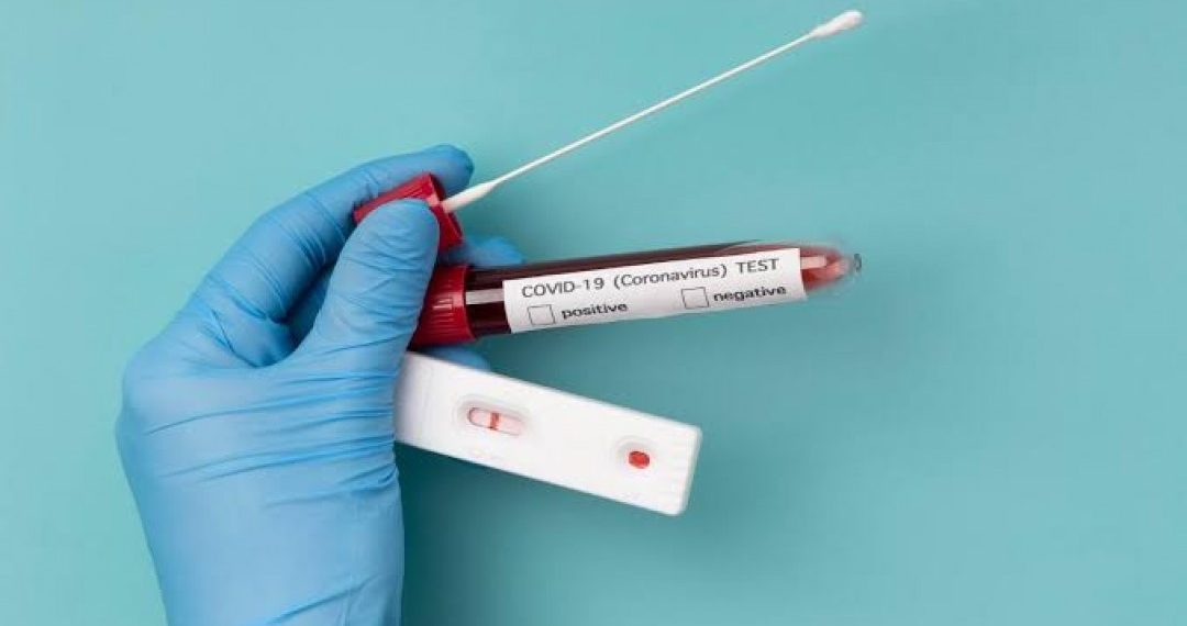 Sesap divulga dados parciais da Covid-19 das últimas 24h no RN; um óbito foi registrado em Parnamirim