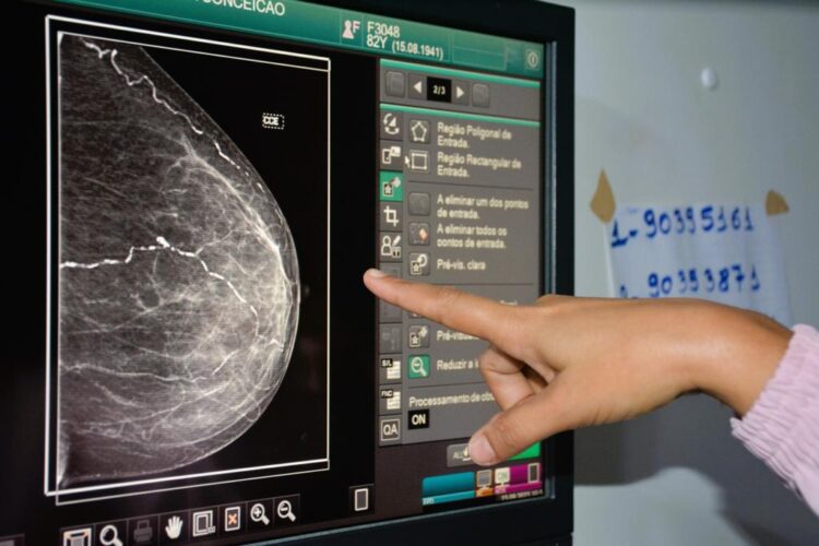 Parnamirim: Caminhão mamografia estará em Jardim Planalto neste Sábado (23)