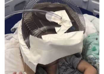 Embalagem de bolo como máscara de oxigênio, falta de equipamento e equipe experiente: o que se sabe sobre internação de bebê no RN