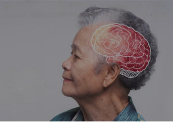 Efeito colateral de quimioterapia pode mascarar sintomas iniciais de Alzheimer