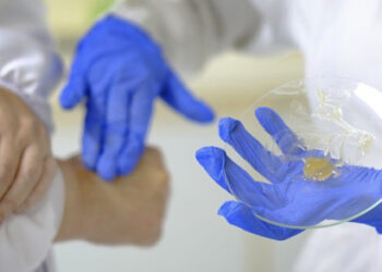 Da folha da catingueira – Pesquisadores desenvolvem gel fitoterápico antibacteriana e antifúngica