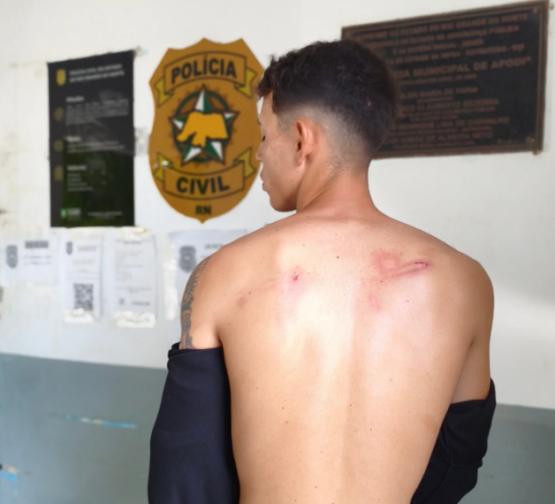 Nova vítima do Carnaval de Apodi: jovem também apresenta denúncia de agressão contra seguranças privados contratados