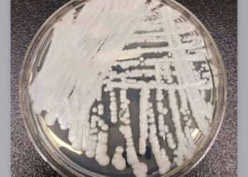 Superfungo: Secretaria de Saúde publica orientações de prevenção após confirmar primeiro caso de Candida auris no RN