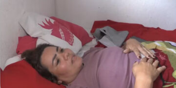 Mulher que caiu de passarela na Grande Natal sofreu fraturas na coluna e bacia e vai ficar três meses acamada