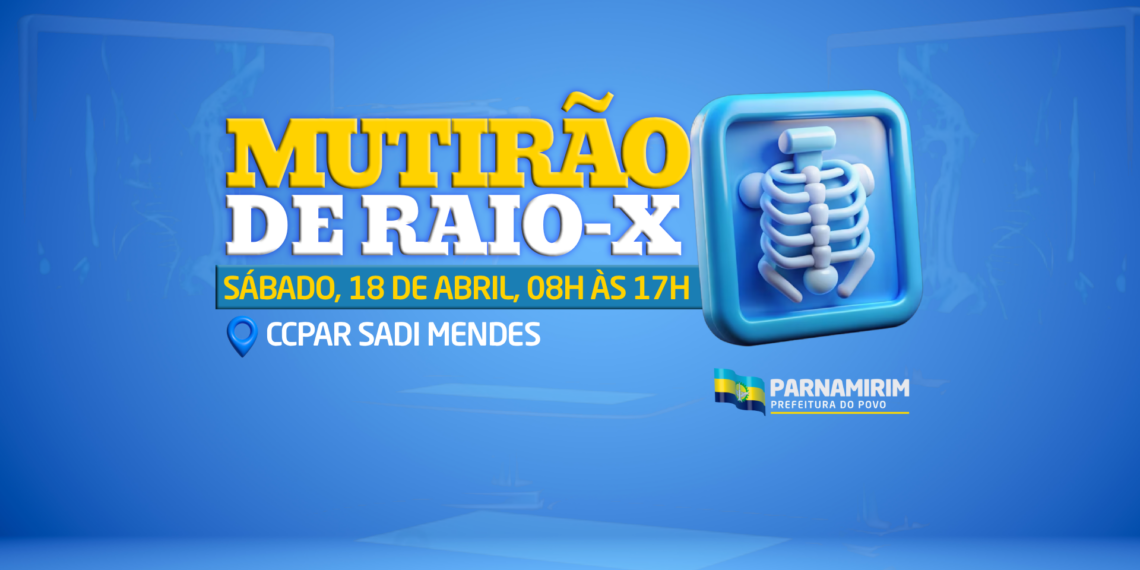 Prefeitura de Parnamirim realizará mutirão de Raio-X neste sábado, 18 de abril