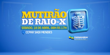 Prefeitura de Parnamirim realizará mutirão de Raio-X neste sábado, 18 de abril