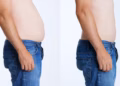 Nutricionistas são proibidos de publicar “antes e depois” e nova regra divide a categoria