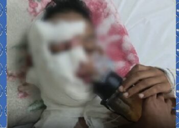 Menino de 11 anos sofre queimaduras após acidente com gasolina em Macaíba