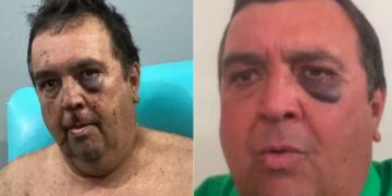 Vereador é agredido e amarrado em sequestro relâmpago no interior do RN; criminosos exigiram transferências