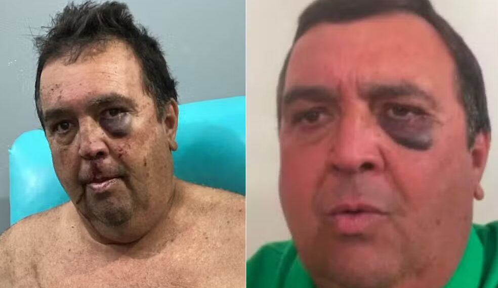 Vereador é agredido e amarrado em sequestro relâmpago no interior do RN; criminosos exigiram transferências