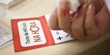 RN lidera alta de casos de HIV no Brasil após a pandemia