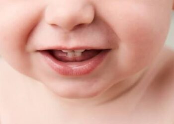 Odontologia para bebês oncológicos e hematológicos