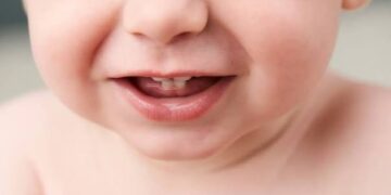 Odontologia para bebês oncológicos e hematológicos