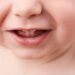 Odontologia para bebês oncológicos e hematológicos