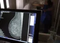 Sesc abre agendamentos para mamografias e preventivos gratuitos em Natal