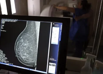 Sesc abre agendamentos para mamografias e preventivos gratuitos em Natal