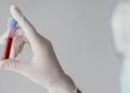 Leucemia: os sinais que não podem ser ignorados