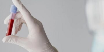 Leucemia: os sinais que não podem ser ignorados