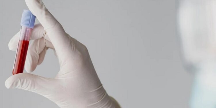 Leucemia: os sinais que não podem ser ignorados