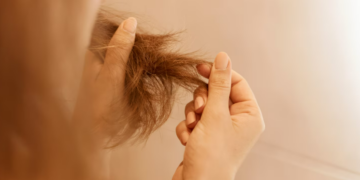 Queda de cabelo pode ser sinal de deficiência de ferro? Médico explica